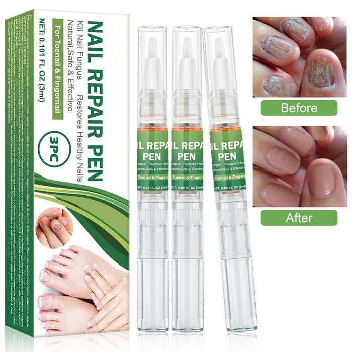 Nagelpflege Stift, Nagel Behandlung Stift, Nagelreparatur Stift für Reparatur gebrochene Nägel lass Fuß und Hand gesunde Nail Treatment Nagelpflege